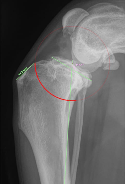TPLO planning radiograph used to assess the knee and tibial plateau