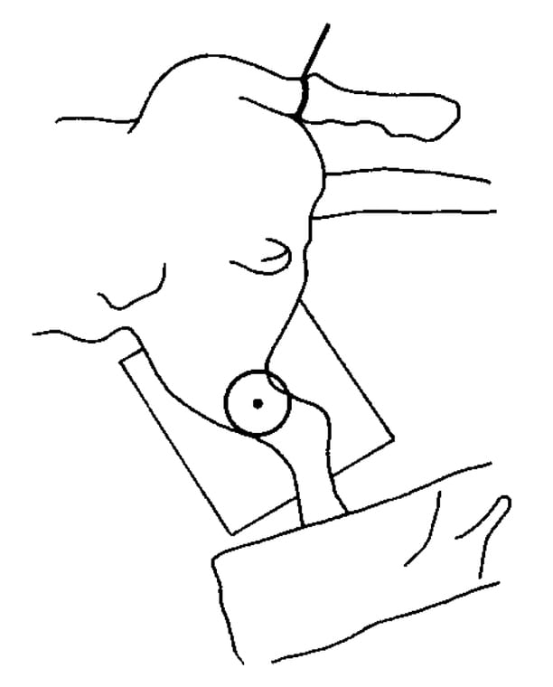 Positioning sketch for a true lateral TPLO planning radiograph with calibration marker