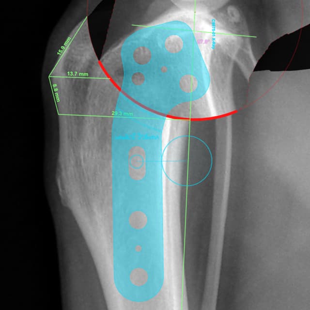 Radiograph planning image for the day 1 recovery album