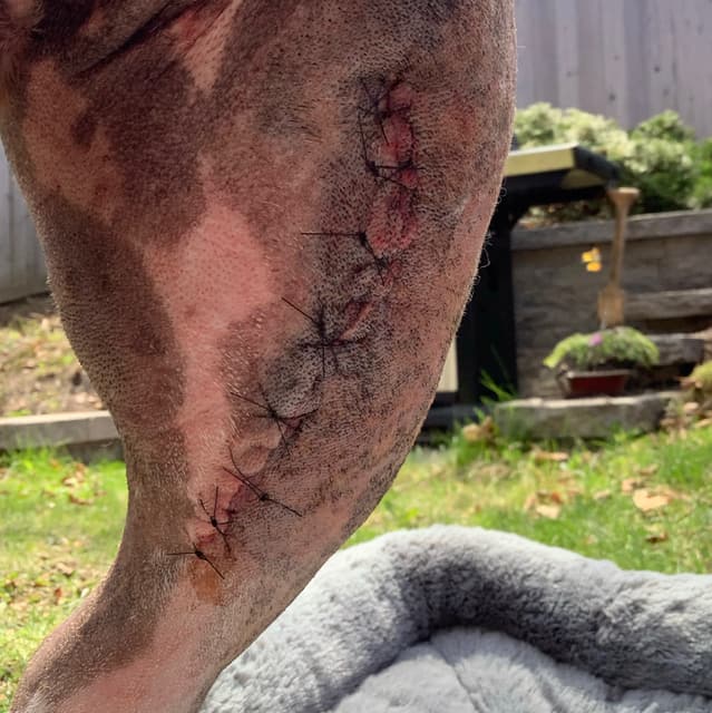Week 1 incision check recovery album thumbnail