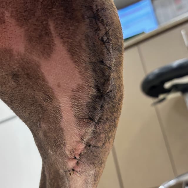 Week 2 incision and mobility recovery album thumbnail